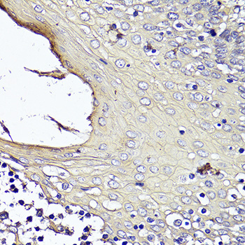 Anti-KRT1 Antibody (CAB16275)