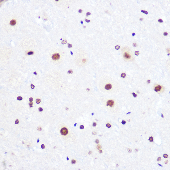 Anti-DDX3X Antibody (CAB5637)