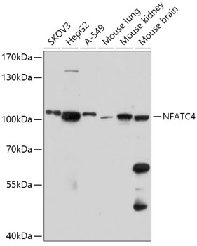 Anti-NFATC4 Antibody (CAB17511)