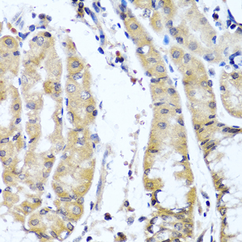 Anti-COL9A1 Antibody (CAB6563)