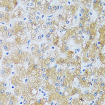 Anti-ASB4 Antibody (CAB17159)