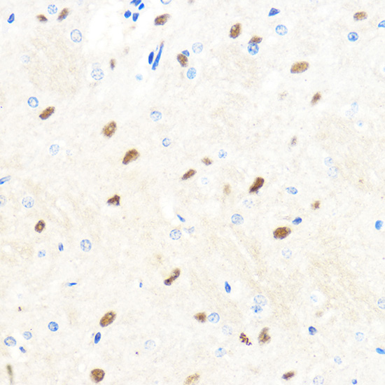 Anti-BRCA1 Antibody (CAB11549)