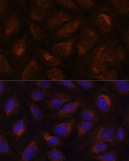 Anti-AGR2 Antibody (CAB7064)