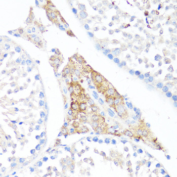 Anti-Fibronectin Antibody (CAB16678)