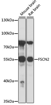 Anti-FSCN2 Antibody (CAB16508)