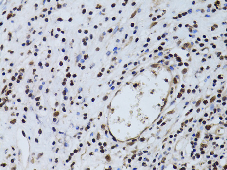 Anti-SIRT7 Antibody (CAB0979)