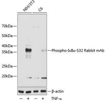 Phospho-IkBAlpha-S32 Rabbit Monoclonal Antibody (CABP0707)