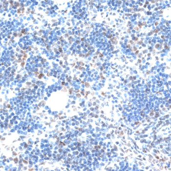 Anti-AQR Antibody (CAB6011)