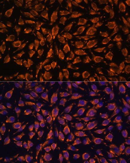 Anti-LRRC7 Antibody (CAB13114)