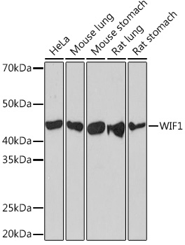 Anti-WIF1 Antibody (CAB5171)