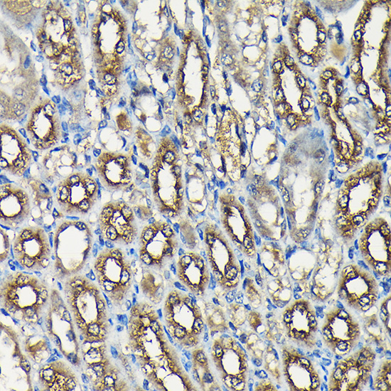 Anti-USP5 Antibody (CAB4202)