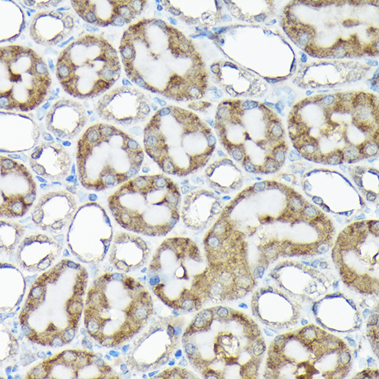 Anti-RPS15A Antibody (CAB10241)