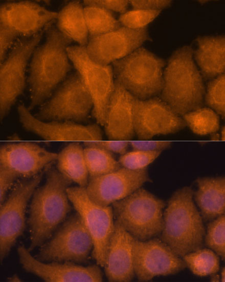 Anti-ZC3H7A Antibody (CAB13190)