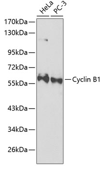 Anti-Cyclin B1 Antibody (CAB2056)