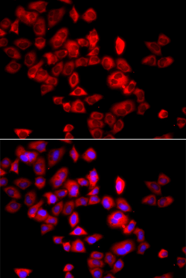 Anti-EIF4G1 Antibody (CAB7552)