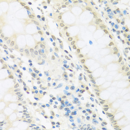 Anti-IRF3 Antibody (CAB2172)