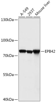 Anti-EPB42 Antibody (CAB17481)