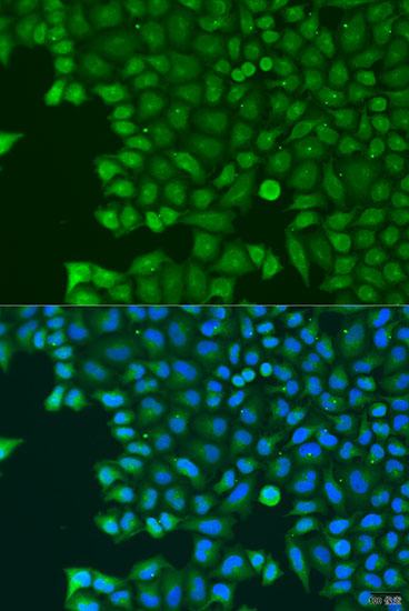 Anti-ABCE1 Polyclonal Antibody (CAB8146)