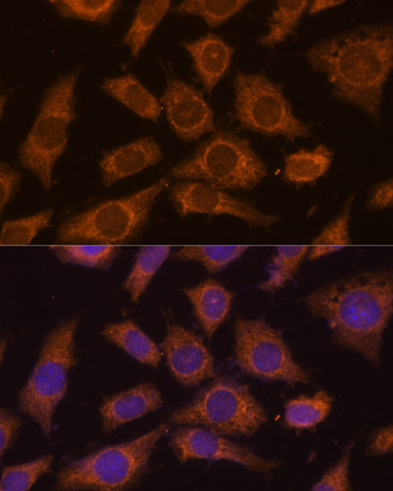 Anti-PREPL Antibody (CAB14348)