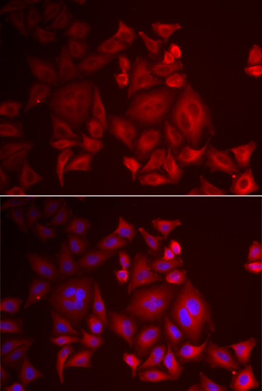 Anti-XCL1 Antibody (CAB6408)