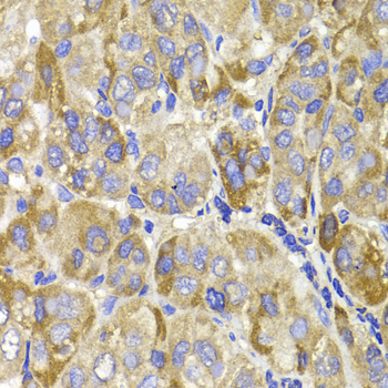 Anti-MAGED1 Antibody (CAB1092)