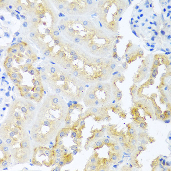 Anti-TDGF1 Antibody (CAB1065)