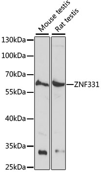 Anti-ZNF331 Antibody (CAB15470)