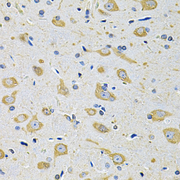 Anti-FASTKD1 Antibody (CAB7384)