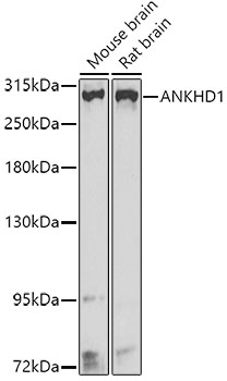 Anti-ANKHD1 Polyclonal Antibody (CAB8224)