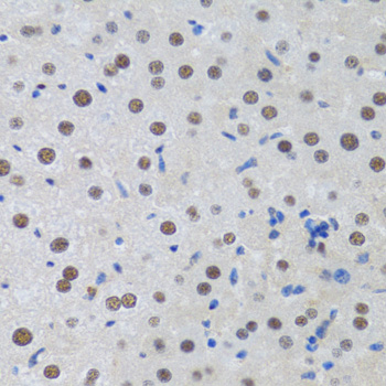 Anti-MTA3 Antibody (CAB6660)