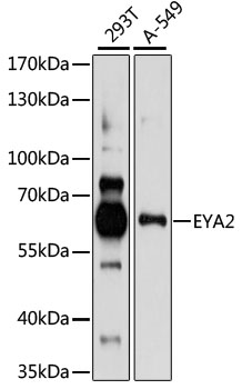 Anti-EYA2 Antibody (CAB15055)