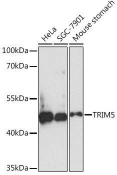 Anti-TRIM5 Antibody (CAB17234)