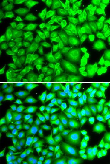 Anti-REG3A Antibody (CAB2101)