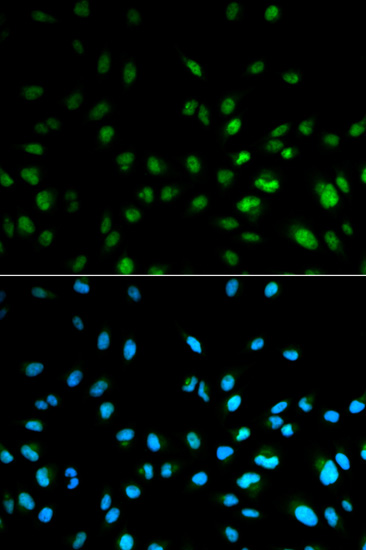 Anti-HDAC3 Antibody (CAB2139)