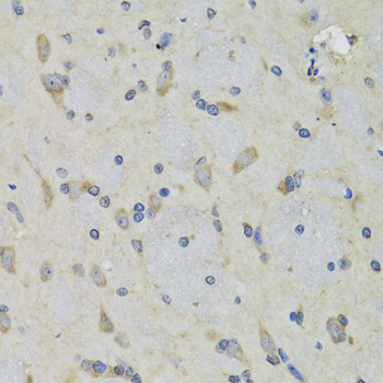 Anti-RAE1 Antibody (CAB6713)