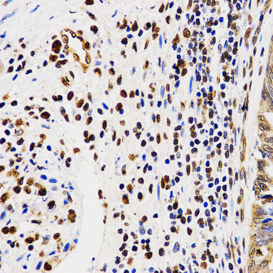 Anti-Asymmetric DiMethyl-Histone H4-R3 Antibody (CAB2376)