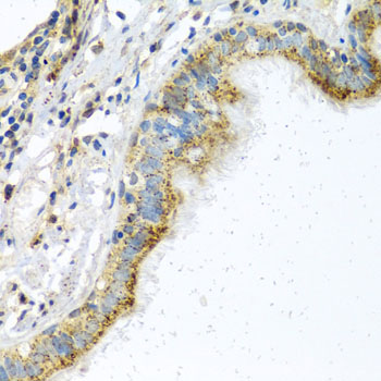 Anti-ATPIF1 Antibody (CAB5099)