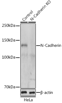 Anti-N-Cadherin Antibody [KO Validated] (CAB0432)