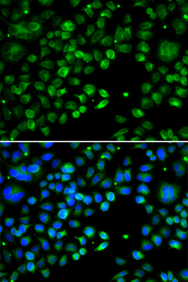 Anti-TXNDC5 Antibody (CAB14152)