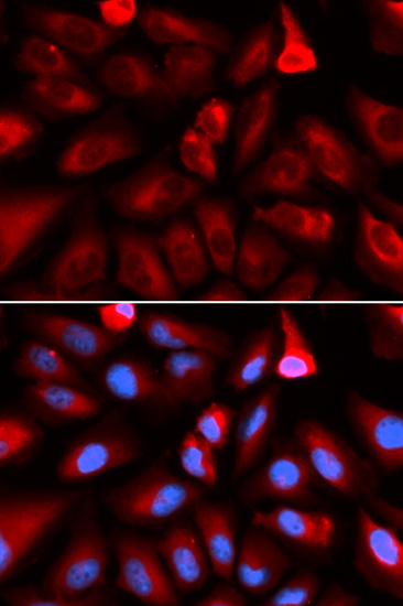 Anti-FKBP4 Antibody (CAB5643)