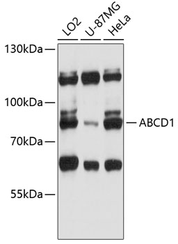 Anti-ABCD1 Antibody (CAB12141)