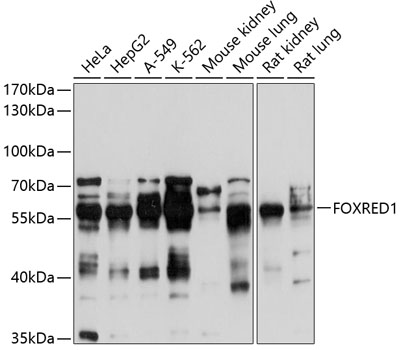 Anti-FOXRED1 Antibody (CAB10369)