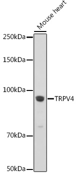 Anti-TRPV4 Antibody (CAB5660)