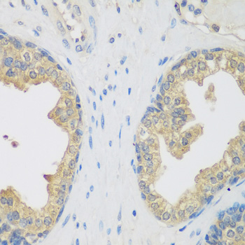 Anti-ENPEP Antibody (CAB6905)