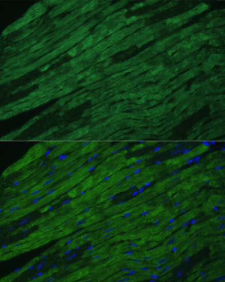 Anti-TNNI3 Antibody (CAB0152)