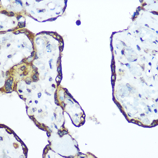 Anti-RhoA Antibody (CAB13947)