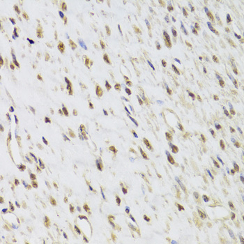 Anti-SEPHS1 Antibody (CAB6454)