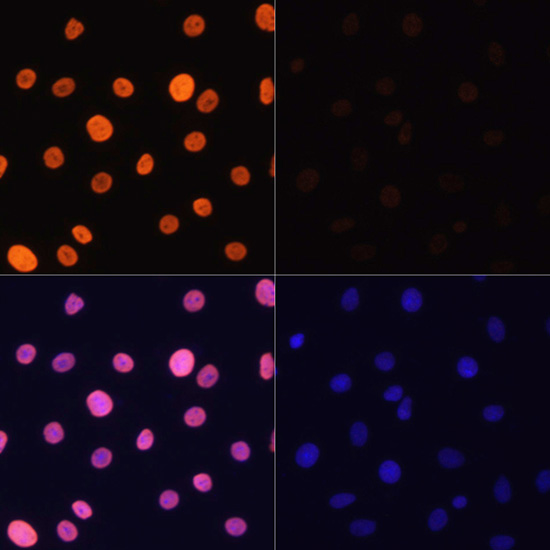 Anti-Acetyl-Histone H3-K4 Antibody (CAB16078)