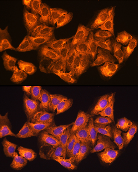 Anti-ZCCHC11 Antibody (CAB5972)