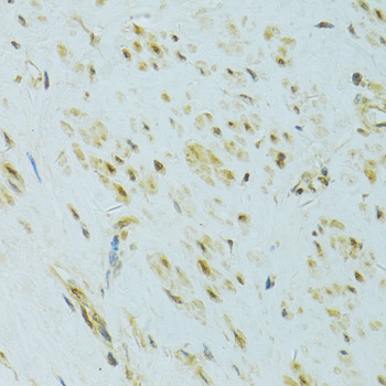 Anti-XBP1 Antibody (CAB14651)